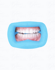 Silicone Mouth Retractor