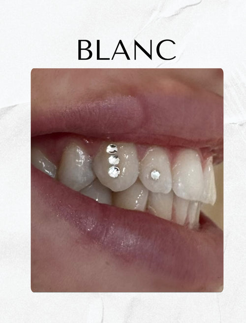 Blanc smile detail result